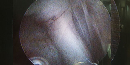 Arthroskopie Schulter Hund Bicepssehne