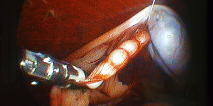 Minimal invasive Kryptorchiden OP Hund