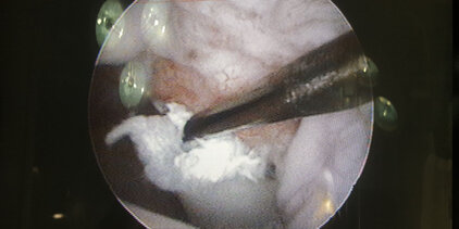 Biceps Tendotomie Hund arthroskopisch