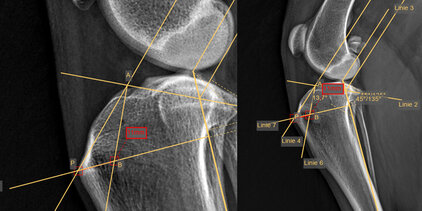 TTA Rapid Messung prä OP Hund Kreuzbandruptur